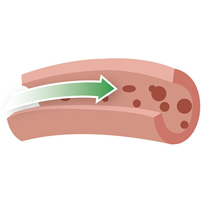 heart health and cholesterol lipotropic adjunct